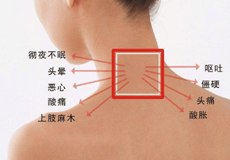 颈椎病方向优秀论文选题精选