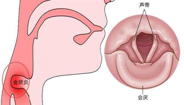 咽喉疾病方面优秀论文精选